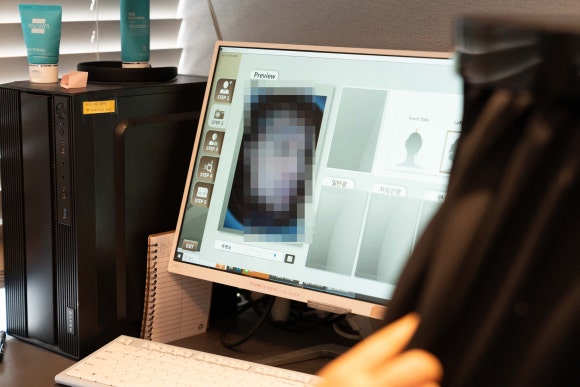 성동구 왕십리 목 릴흑피증(릴흑색증) 실제 치료 사례 관련 이미지 4