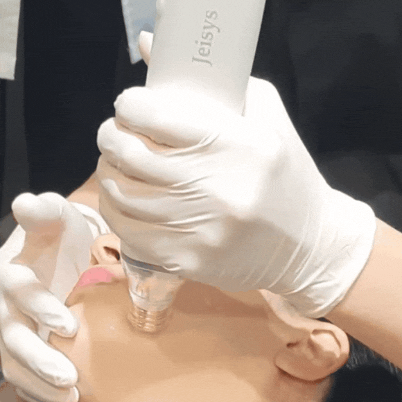 포텐자리프팅? 피부과 전문의 대표원장이 정리 해드립니다 관련 이미지 7