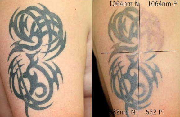 성동구피부과 추천? 반드시 확인해야 할 2가지 관련 이미지 5