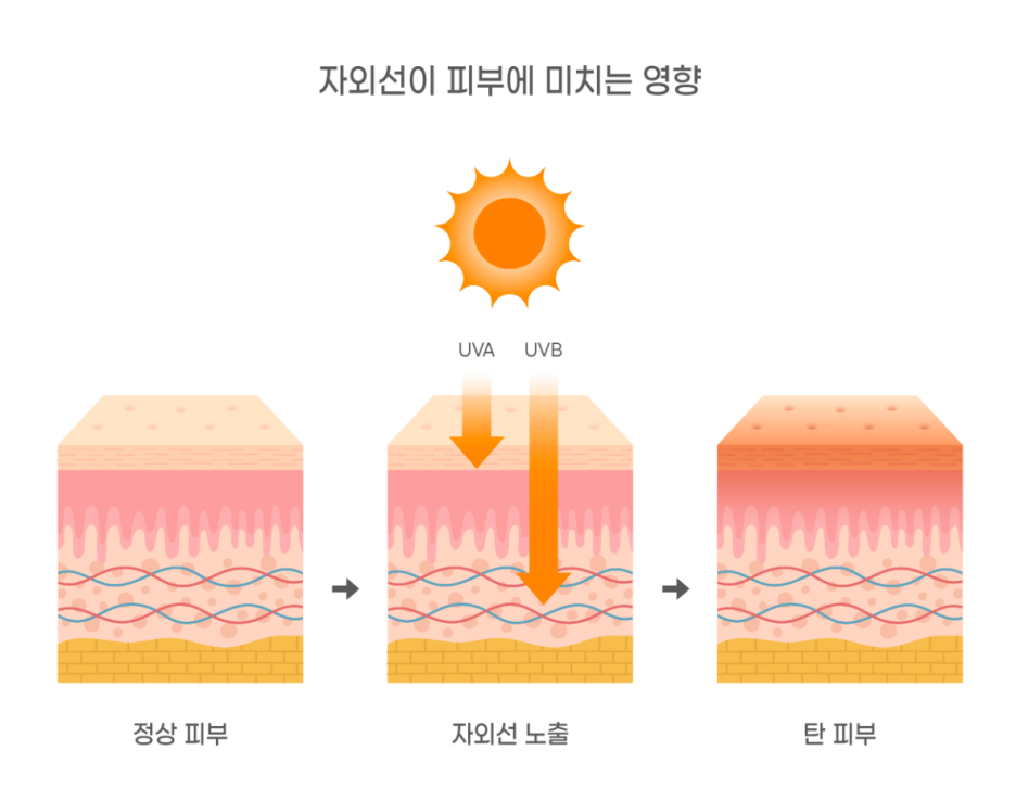 왕십리피부과? 어두운 피부톤이 보기 싫다면 <필독> 관련 이미지 3