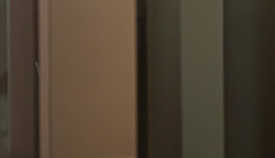 왕십리 레이저제모? 거뭇거뭇한 수염 제거하기 <실제 시술 후기> 관련 이미지 16