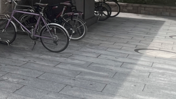 성동구 왕십리 목 릴흑피증(릴흑색증) 실제 치료 사례 관련 이미지 9