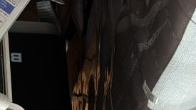 왕십리 기미제거 잡티제거, 효과 못 봤다면 관련 이미지 12