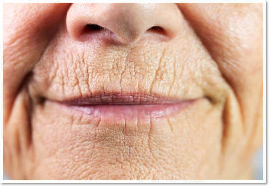 왕십리피부과추천 잘하는곳 유명한곳? 어디로 내원할지 모르겠다면 관련 이미지 3