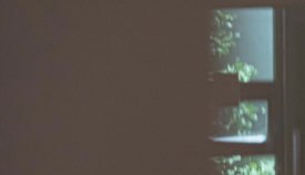 왕십리 레이저제모? 거뭇거뭇한 수염 제거하기 <실제 시술 후기> 관련 이미지 12