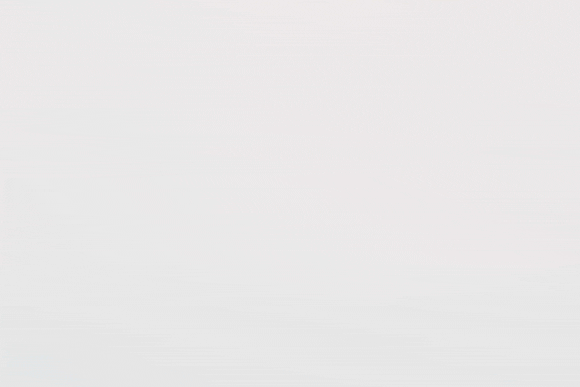 왕십리 인모드 리프팅 이런 분들은 받지 마세요 관련 이미지 16