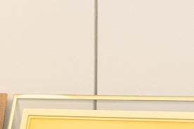 성동구리프팅, 어떤 시술을 받을지 고민이라면? 관련 이미지 12