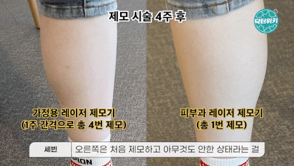 왕십리역레이저제모? 잘 하는 곳의 1가지 특징 관련 이미지 7