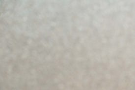 왕십리주근깨, 완전히 없애고 싶다면 읽어보세요 관련 이미지 9