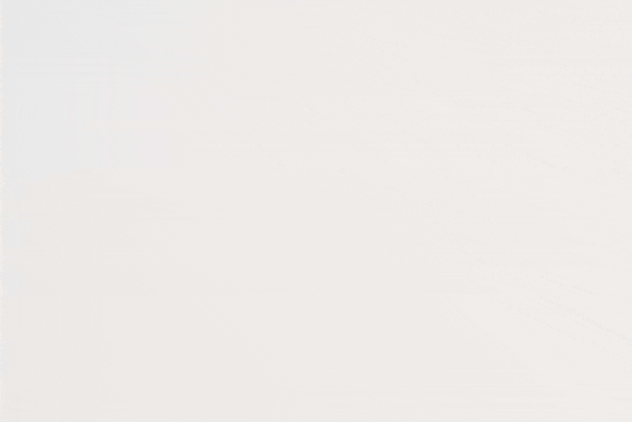 왕십리 인모드 리프팅 이런 분들은 받지 마세요 관련 이미지 10