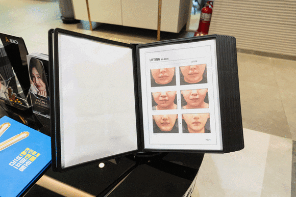 마장역피부과, 처진 피부 해결 받고 싶으시다면 관련 이미지 8