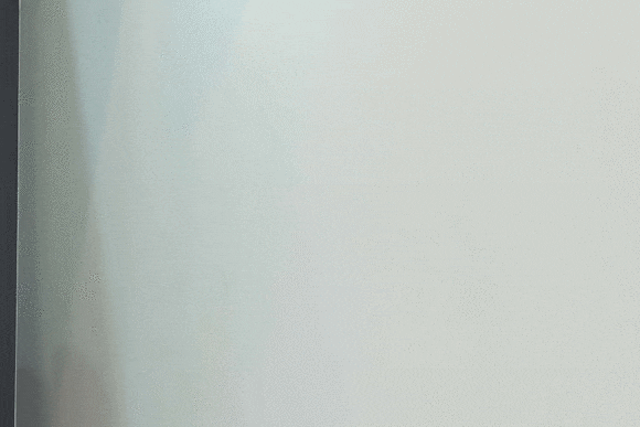 왕십리 인모드 리프팅 이런 분들은 받지 마세요 관련 이미지 15