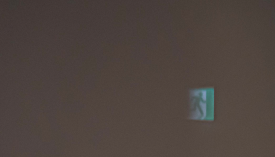 왕십리 레이저제모? 거뭇거뭇한 수염 제거하기 <실제 시술 후기> 관련 이미지 9