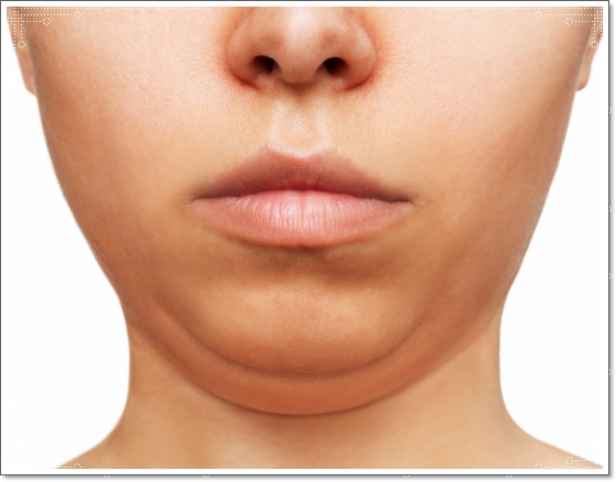 인모드FX포마차이? 피부과 전문의가 알려드립니다 관련 이미지 5