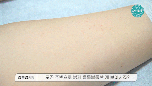 성동구 반영구제모, 셀프 시술과 얼마나 다를까 <시술 후기> 관련 이미지 6