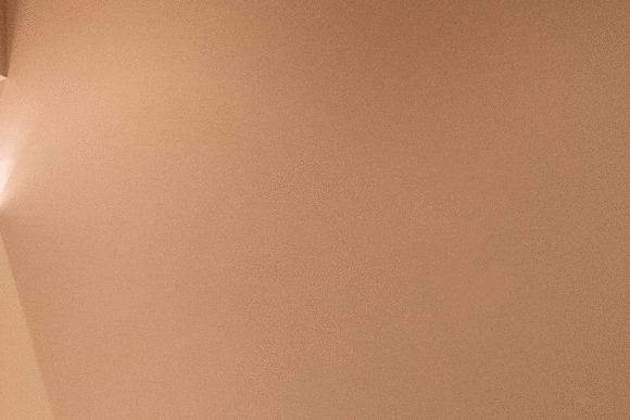 왕십리피부과 탄력이 떨어진다 느낀다면 <전문의 작성> 관련 이미지 10