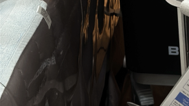 왕십리역 피부과, 반드시 확인해야 하는 2 가지? <필독> 관련 이미지 17