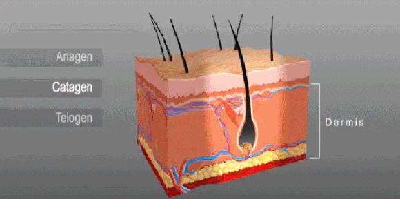 성동구 레이저제모, 제대로 효과 보려면 관련 이미지 3