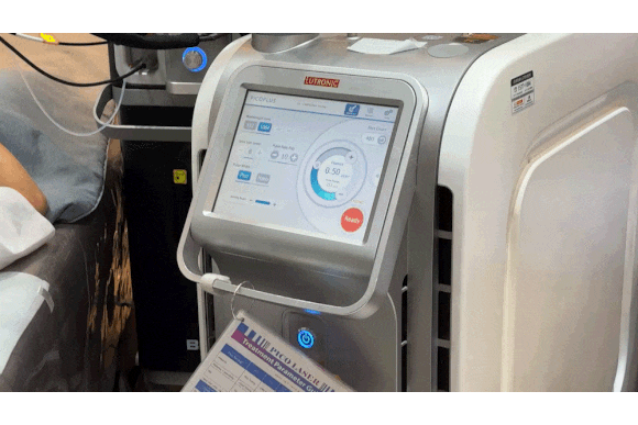 왕십리피코토닝, 기미가 고민이시라면? 관련 이미지 5