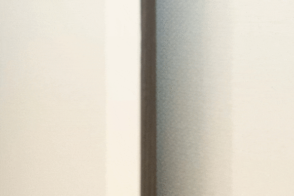 마장역피부과, 처진 피부 해결 받고 싶으시다면 관련 이미지 18