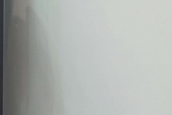 왕십리 인모드 리프팅 이런 분들은 받지 마세요 관련 이미지 18