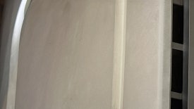 왕십리 기미제거 잡티제거, 효과 못 봤다면 관련 이미지 10