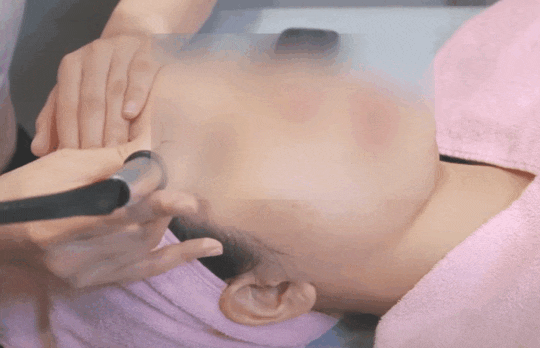 왕십리아쿠아필, 블랙헤드가 고민이라면? 관련 이미지 3