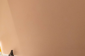 성동구쥬베룩 모공과 흉터가 고민이시라면 <필독> 관련 이미지 14