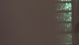 왕십리 레이저제모? 거뭇거뭇한 수염 제거하기 <실제 시술 후기> 관련 이미지 15