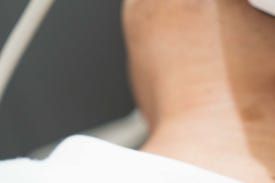 성동구 인모드리프팅, 브이라인을 원하신다면 관련 이미지 15