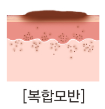 왕십리점제거 피부과 알아보신다면 관련 이미지 4