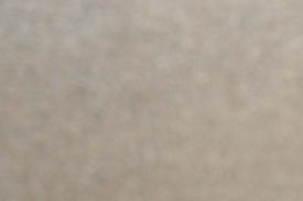 왕십리주근깨, 완전히 없애고 싶다면 읽어보세요 관련 이미지 12