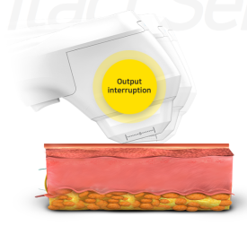 성동구 브이로리프팅, 핫한 이유가 궁금하다면? 관련 이미지 4