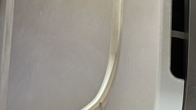 왕십리 기미제거 잡티제거, 효과 못 봤다면 관련 이미지 13