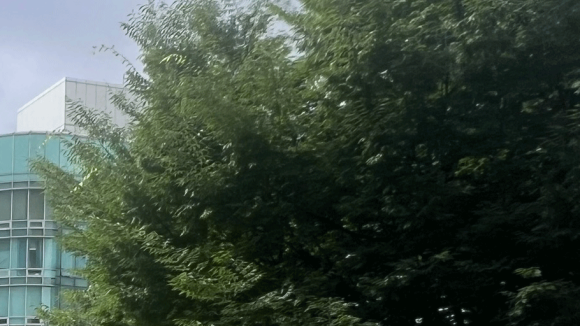 성동구 왕십리 목 릴흑피증(릴흑색증) 실제 치료 사례 관련 이미지 15