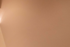 성동구쥬베룩 모공과 흉터가 고민이시라면 <필독> 관련 이미지 11