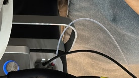 왕십리 기미제거 잡티제거, 효과 못 봤다면 관련 이미지 18