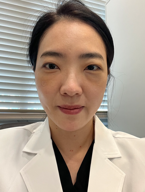 코그실리프팅, 대표원장이 직접 시술받아 봤습니다 관련 이미지 14