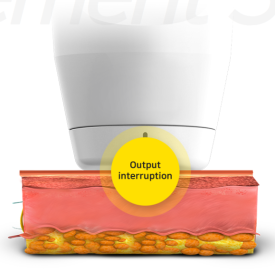 성동구 브이로리프팅, 핫한 이유가 궁금하다면? 관련 이미지 5