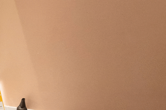 왕십리피부과 탄력이 떨어진다 느낀다면 <전문의 작성> 관련 이미지 13