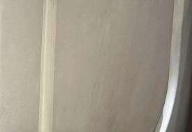 왕십리 잡티제거 레이저로 깨끗하게 <실제 시술 후기> 관련 이미지 17