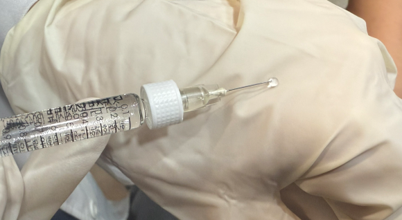 왕십리입술필러? 비대칭 개선한 실제 케이스 보여드립니다 관련 이미지 6