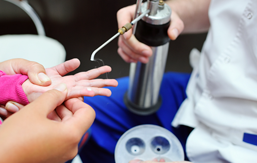 왕십리사마귀? 딱딱한 각질이 못생겨 보인다면 읽어주세요 관련 이미지 4