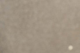 왕십리주근깨, 완전히 없애고 싶다면 읽어보세요 관련 이미지 15