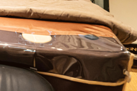 왕십리 리프팅, 올리지오 팔자주름 개선 시술 후기 관련 이미지 17