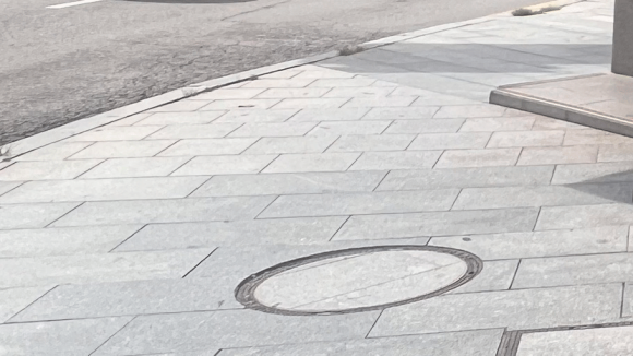 성동구 왕십리 목 릴흑피증(릴흑색증) 실제 치료 사례 관련 이미지 11