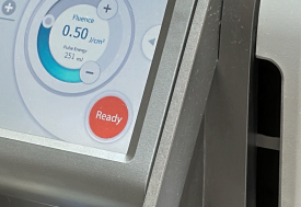 왕십리 잡티제거 레이저로 깨끗하게 <실제 시술 후기> 관련 이미지 13