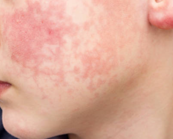 왕십리포텐자? 다재다능한 시술 찾는다면 <필독> 관련 이미지 7