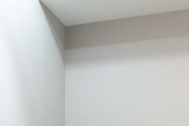 성동구 레이저제모, 제대로 효과 보려면 관련 이미지 11