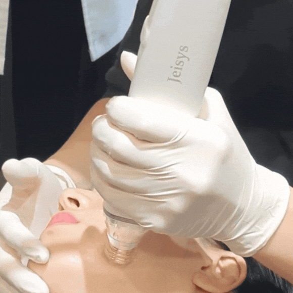 포텐자리프팅? 피부과 전문의 대표원장이 정리 해드립니다 관련 이미지 8